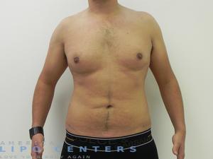 americanlipocenters_114.jpg